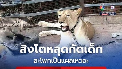 สิงโตหลุดกัดเด็ก 11 ขวบ สะโพกเป็นแผลเหวอะ พบเจ้าของเคยเป็นข่าวดัง