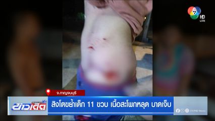 สิงโตขย้ำเด็ก 11 ขวบ เนื้อสะโพกหลุด บาดเจ็บ