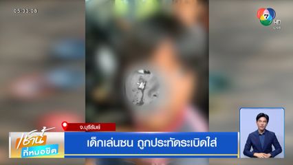 เด็กเล่นซน ถูกประทัดระเบิดใส่