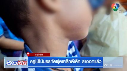 ครูใช้ไม้บรรทัดฟุตเหล็กตีเด็ก ลาออกแล้ว