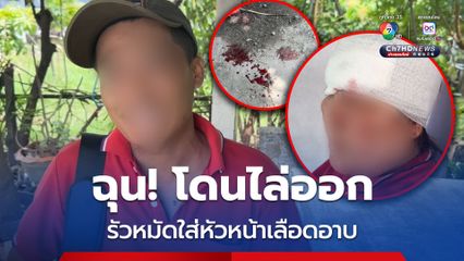 หนุ่มเมียนมา ฉุน! อ้างโดนต่อว่า-ไล่ออก รัวหมัดใส่หัวหน้าหญิงวัย 50 ปี เลือดอาบ