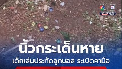 เด็ก 12 ขวบ เล่นประทัดลูกบอล ระเบิดคามือ นิ้วกระเด็นหาย หาไม่เจอ