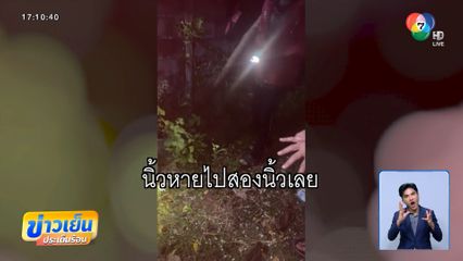 สุดสลด ! ประทัดแตกคามือเด็ก 12 ขวบ