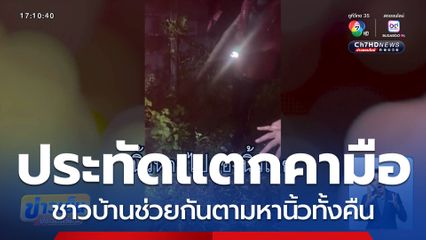 สุดสลด ! ประทัดแตกคามือเด็ก 12 ขวบ