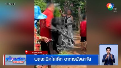 อุทาหรณ์ ! พลุระเบิดใส่เด็ก รุนแรงถึงขั้นหน้าผากเปิด อาการยังสาหัส