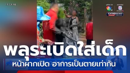 อุทาหรณ์ ! พลุระเบิดใส่เด็ก รุนแรงถึงขั้นหน้าผากเปิด อาการยังสาหัส