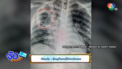 เตือนภัย ! ฟันผุเป็นเหตุให้ปอดมีหนอง