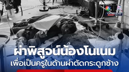 ลูกช้างขาหัก ล้มแล้ว ผ่าพิสูจน์เพื่อเป็นครูในด้านการผ่าตัดกระดูกช้าง