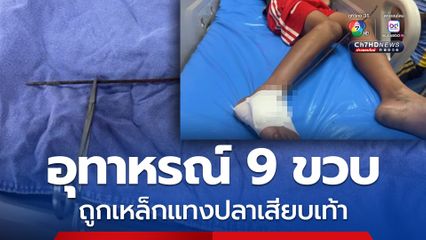 ปิดเทอม เด็ก 9 ขวบ ถูกเหล็กแหลนแทงปลาทะลุเท้า ขณะตกปลากับเพื่อน