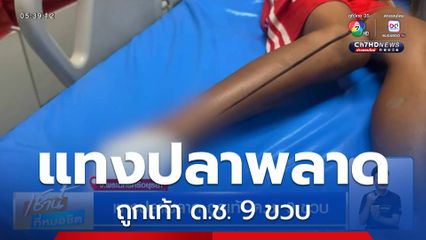 แทงปลาพลาด ถูกเท้า ด.ช. 9 ขวบ