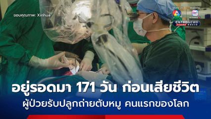 ผู้ป่วยที่รับการปลูกถ่าย “ตับหมู” คนแรกของโลก อยู่รอดนาน 171 วัน และได้เสียชีวิตลง 