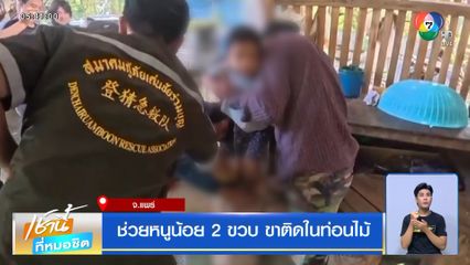 ช่วยหนูน้อย 2 ขวบ ขาติดในท่อนไม้