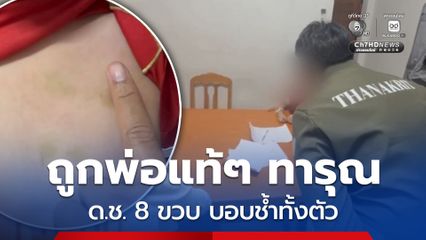 ช่วยเด็กชาย 8 ขวบ ถูกพ่อแท้ ๆ ทารุณกรรมนานนับปี