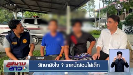 รักษายังไง ? หมอราดน้ำร้อนใส่เด็ก หลังมีไข้ ไปรักษาที่คลินิก จนเป็นแผลพุพอง