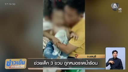 ช่วยเด็ก 3 ขวบ ถูกหมอราดน้ำร้อน