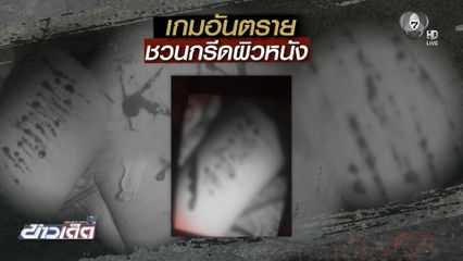 เกมอันตราย ชวนกรีดผิวหนัง