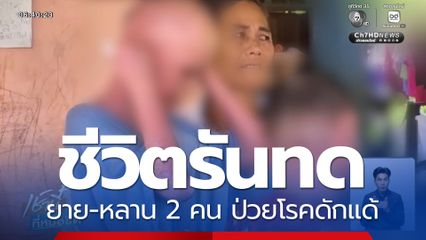ชีวิตรันทด ยาย-หลาน 2 คน ป่วยโรคดักแด้ จ.อุดรธานี