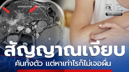หมอเจดเตือน สัญญาณเงียบ คันทั้งตัว แต่หาเท่าไรก็ไม่เจอผื่น