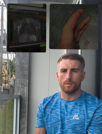 ONE Championship : โจนาธาน แฮ็กเกอร์ตี โชว์หลักฐานอาการเจ็บ เหตุถอนชก นาบิล อานาน ศึก ONE 173