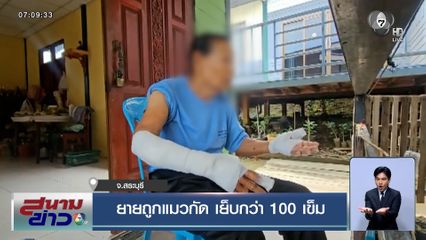 ยายถูกแมวกัด เย็บกว่า 100 เข็ม