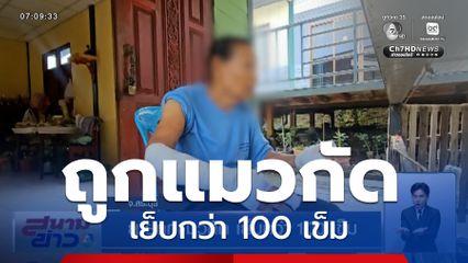 ยายถูกแมวกัด เย็บกว่า 100 เข็ม