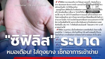 หมอเตือน! ซิฟิลิส ระบาด ชี้ ควรใส่ถุงยาง เช็กอาการเข้าข่าย