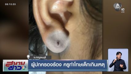 ผู้ปกครองร้อง ครูทำโทษเด็กเกินเหตุ