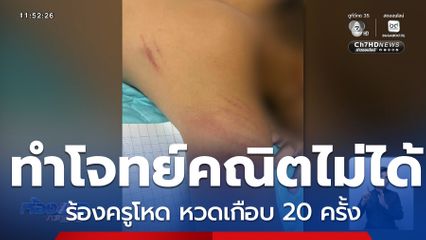 ผู้ปกครองร้องสื่อ ครูทำโทษลูกเกินเหตุ