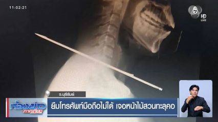 ยืมโทรศัพท์มือถือไม่ได้ เจอหน้าไม้สวนทะลุคอ