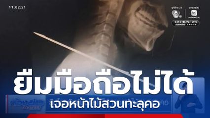 ยืมโทรศัพท์มือถือไม่ได้ เจอหน้าไม้สวนทะลุคอ