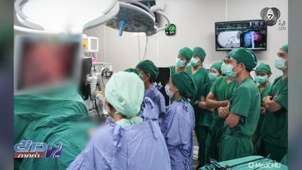 ทีมแพทย์ มช.ปลูกถ่ายตับในฝาแฝดสำเร็จ