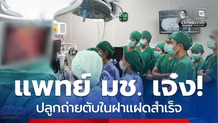 ทีมแพทย์ มช.ปลูกถ่ายตับในฝาแฝดสำเร็จ