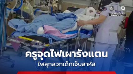 ครูจุดไฟเผารังแตน เรีกยเด็กนักเรียนช่วย ไฟลุกลวกเด็กเจ็บสาหัส