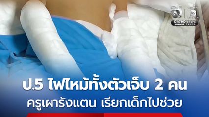 ครูเผารังแตน เรียกเด็ก ป.5 จำนวน 2 คนไปช่วยในฐานะจิตอาสา หลังจากนั้นเกิดไฟลุกไหม้ทั้งตัวของเด็กทั้ง 2 คน บาดเจ็บสาหัส