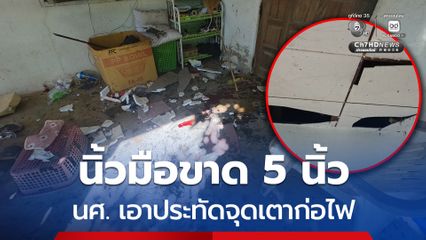นิ้วมือขาด 5 นิ้ว นศ. เอาประทัดจุดเตาก่อไฟ ระเบิดใส่คามือ
