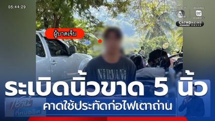 คาดใช้ประทัดก่อไฟเตาถ่าน ระเบิดนิ้วขาด 5 นิ้ว
