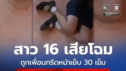 สาว 16 เสียโฉม ถูกเพื่อนกรีดหน้าเย็บ 30 เข็ม