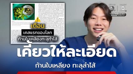 หมอยกเคสอุทาหรณ์ ก้านใบเหลียงทะลุลำไส้ ปวดท้องคล้ายไสติ่ง