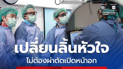 ศูนย์หัวใจสิริกิติ์ฯ ยกระดับเปลี่ยนลิ้นหัวใจ ไม่ต้องผ่าตัดเปิดหน้าอก