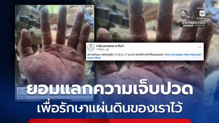 ภาพมือของทหารไทย ผู้ยอมแลกความเจ็บปวดของตน เพื่อรักษาแผ่นดินของเราไว้