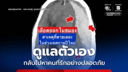 เลือดออกในสมอง สาเหตุเสียชีวิตมากในช่วงเทศกาลปีใหม่