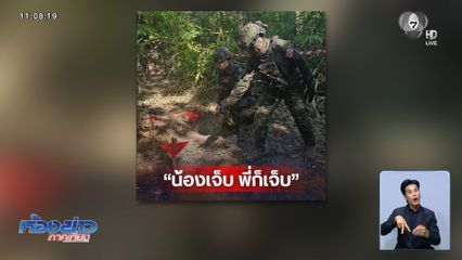 โฆษก ทร.ย้ำ น้องเจ็บ พี่เจ็บ เหยียบทุ่นระเบิดกัมพูชา