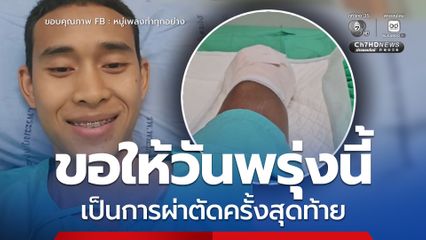 หมู่เพลง ขอกำลังใจ อยากให้การผ่าตัดขาเป็นครั้งสุดท้าย