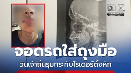 ไรเดอร์จอดรถใส่ถุงมือ ถูกวิน จยย.เจ้าถิ่นรุมกระทืบดั้งหัก-ร่างช้ำ