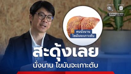 อจ.หมอสุรัตน์ เตือนนั่งนานเสี่ยงไขมันเกาะตับ