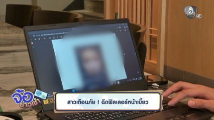 สาวเตือนภัย ฉีดฟิลเลอร์หน้าเบี้ยว