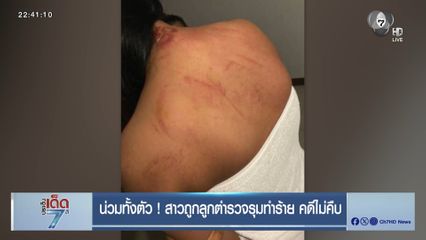 น่วมทั้งตัว ! สาวถูกลูกตำรวจรุมทำร้าย คดีไม่คืบ