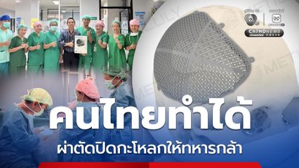 นวัตกรรมสัญชาติไทย ผ่าตัดปิดกะโหลกให้ทหารกล้า