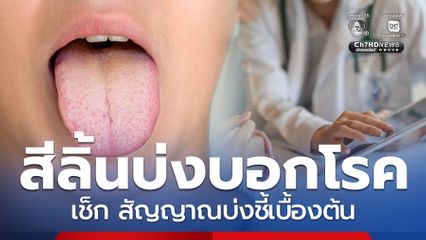 สีลิ้นบ่งบอกโรคได้ แนะสังเกต สัญญาณบ่งชี้สุขภาพเบื้องต้น