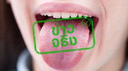 สีลิ้นบ่งบอกโรคได้ แนะสังเกต สัญญาณบ่งชี้สุขภาพเบื้องต้น